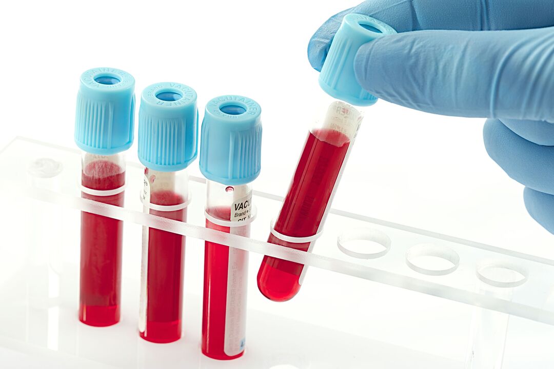 krvný test na diagnostiku ľudského papilomavírusu