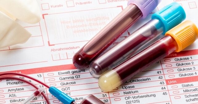 Krvný test na ľudský papilomavírus